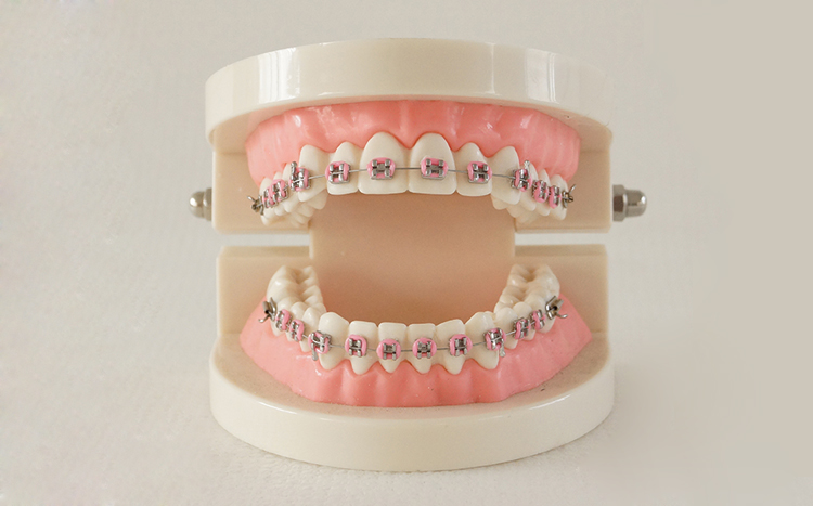 TM-B9-01 Ortho Metal Brcker